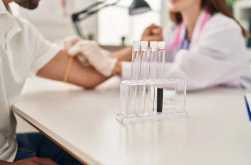 Comparing Home Lab Testing vs. Traditional Lab Visits