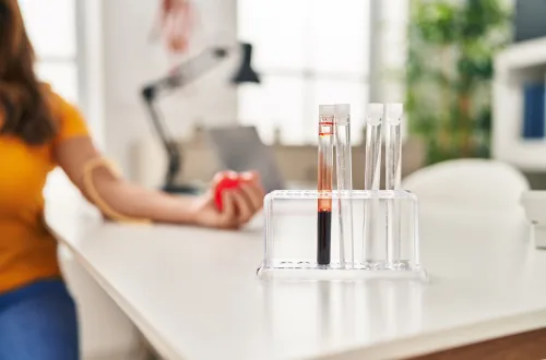 The Rise of At-Home Laboratory Services
