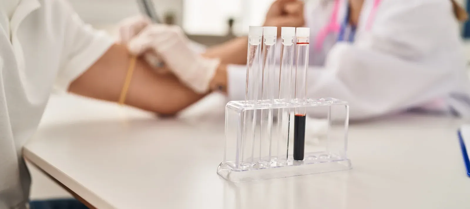 Healthcare That Comes to You: The Smart Shift to Home Lab Testing