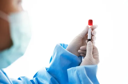 The Benefits of Home Blood Testing
