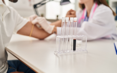 Comparing Home Lab Testing vs. Traditional Lab Visits