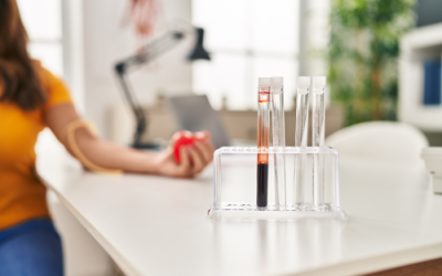 الرعاية الصحية ببساطة: تطور خدمات المختبر المنزلي