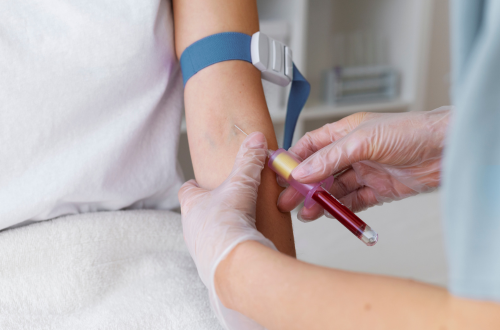 From Home Sample Collection to Reliable Results