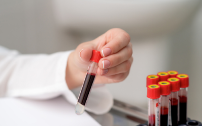 Simplifying Diagnostics: Why Home Laboratory Services Are Here to Stay
