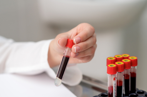 Why Home Laboratory Services Are Here to Stay
